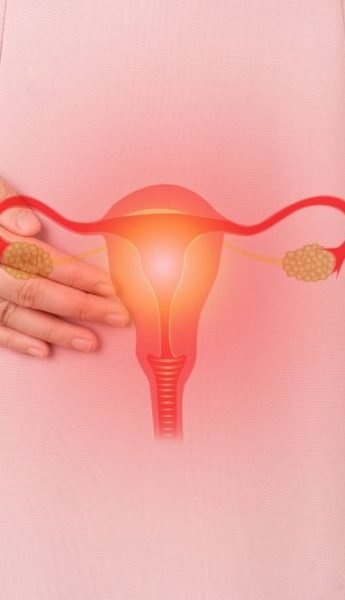 jpeg-optimizer_endometriosis-web-img